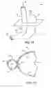 Fig. 02 - Obesity treatment tools and methods
