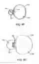 Fig. 08 - Obesity treatment tools and methods