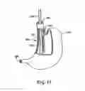 Fig. 15 - Obesity treatment tools and methods