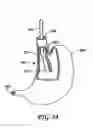 Fig. 16 - Obesity treatment tools and methods