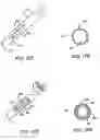 Fig. 20 - Obesity treatment tools and methods