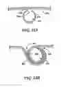 Fig. 23 - Obesity treatment tools and methods