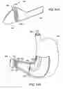 Fig. 33 - Obesity treatment tools and methods