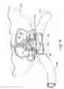 Fig. 37 - Obesity treatment tools and methods