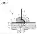 Fig. 02 - Puncture device