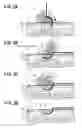 Fig. 03 - Puncture device