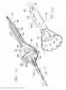 Fig. 11 - Embolic protection devices
