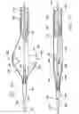 Fig. 12 - Embolic protection devices