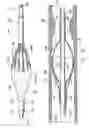 Fig. 16 - Embolic protection devices