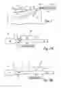 Fig. 02 - Wound drain removal device