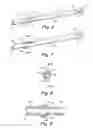 Fig. 04 - Catch members for occluder devices