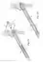 Fig. 11 - Catch members for occluder devices