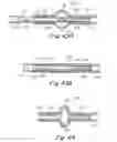 Fig. 18 - Catch members for occluder devices