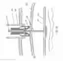 Fig. 16 - METHODS AND DEVICES FOR PERCUTANEOUSLY MODIFYING ORGANS TO TREAT PATIENTS