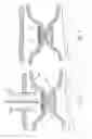 Fig. 17 - METHODS AND DEVICES FOR PERCUTANEOUSLY MODIFYING ORGANS TO TREAT PATIENTS