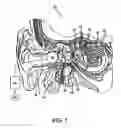 Fig. 03 - System and method for controlling hypothalamic function via vestibular stimulation