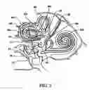 Fig. 05 - System and method for controlling hypothalamic function via vestibular stimulation