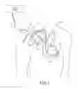 Fig. 02 - Method and apparatus for post-processing of episodes detected by a medical device