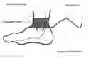 Fig. 01 - Method and apparatus for low frequency induction therapy for the treatment of urinary incontinence and overactive bladder