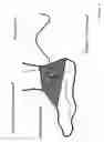 Fig. 03 - Method and apparatus for low frequency induction therapy for the treatment of urinary incontinence and overactive bladder