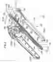 Fig. 03 - Stent delivery system