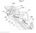 Fig. 10 - Stent delivery system