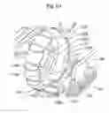 Fig. 11 - Stent delivery system