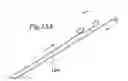 Fig. 15 - Stent delivery system