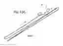 Fig. 17 - Stent delivery system