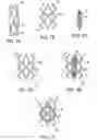 Fig. 07 - Percutaneous Transcatheter Heart Valve