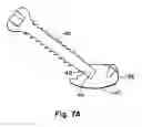Fig. 07 - Prostheses, tools and methods for replacement of natural facet joints with artificial facet joint surfaces