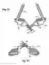 Fig. 09 - Prostheses, tools and methods for replacement of natural facet joints with artificial facet joint surfaces