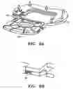 Fig. 06 - Prosthetic intervertebral discs having substantially rigid end plates and fibers between those end plates