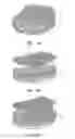 Fig. 03 - Prosthetic intervertebral discs