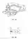Fig. 06 - Prosthetic intervertebral discs