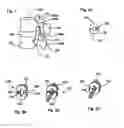 Fig. 02 - Prosthetic facet and facet joint replacement device