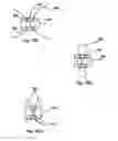 Fig. 09 - Prosthetic facet and facet joint replacement device