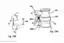 Fig. 13 - Prosthetic facet and facet joint replacement device