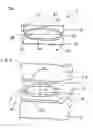 Fig. 02 - Orthopedic implant