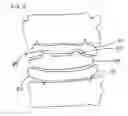 Fig. 04 - Orthopedic implant