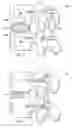 Fig. 03 - Materials, devices and methods for treating multiple spinal regions including vertebral body and endplate regions