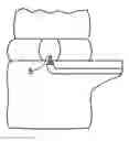 Fig. 01 - Method and instruments for intervertebral disc augmentation through a pedicular approach