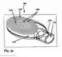 Fig. 03 - Devices and methods for disc replacement