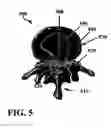 Fig. 07 - Devices and methods for disc replacement
