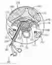 Fig. 01 - Percutaneous cervical disc reconstruction