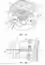 Fig. 03 - Percutaneous cervical disc reconstruction