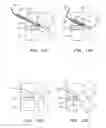 Fig. 14 - Percutaneous cervical disc reconstruction