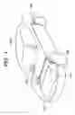 Fig. 02 - Control apparatus of irradiating direction of vehicle lamp and initializing method thereof