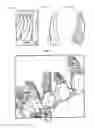 Fig. 14 - System and method for facilitating automated dental measurements and diagnostics