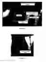 Fig. 32 - System and method for facilitating automated dental measurements and diagnostics